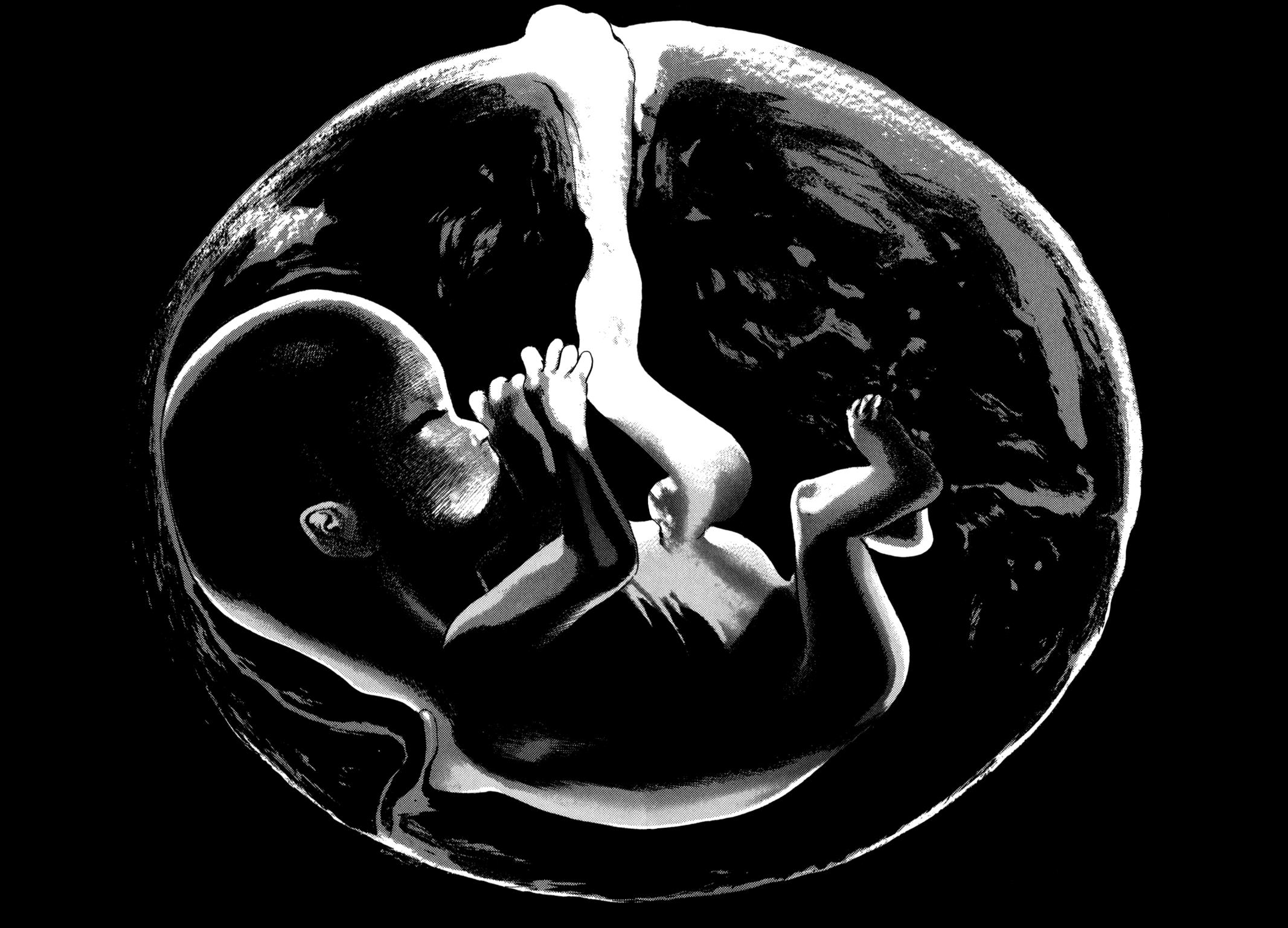 Read Homunculus en Manga Online